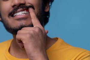 Cirurgia plástica gengival é um procedimento para melhorar a harmonia entre lábios, dentes e linhas do sorriso